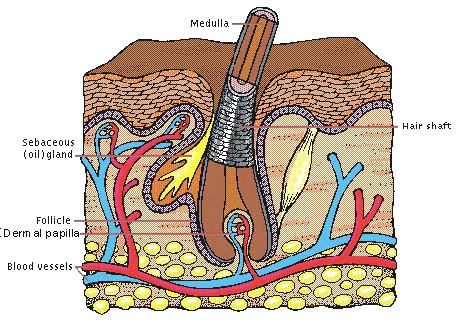 hallux rigidus first MTP joint OA