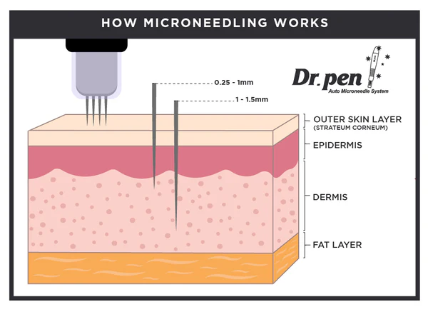 regenerative joint injection knee shoulder pain