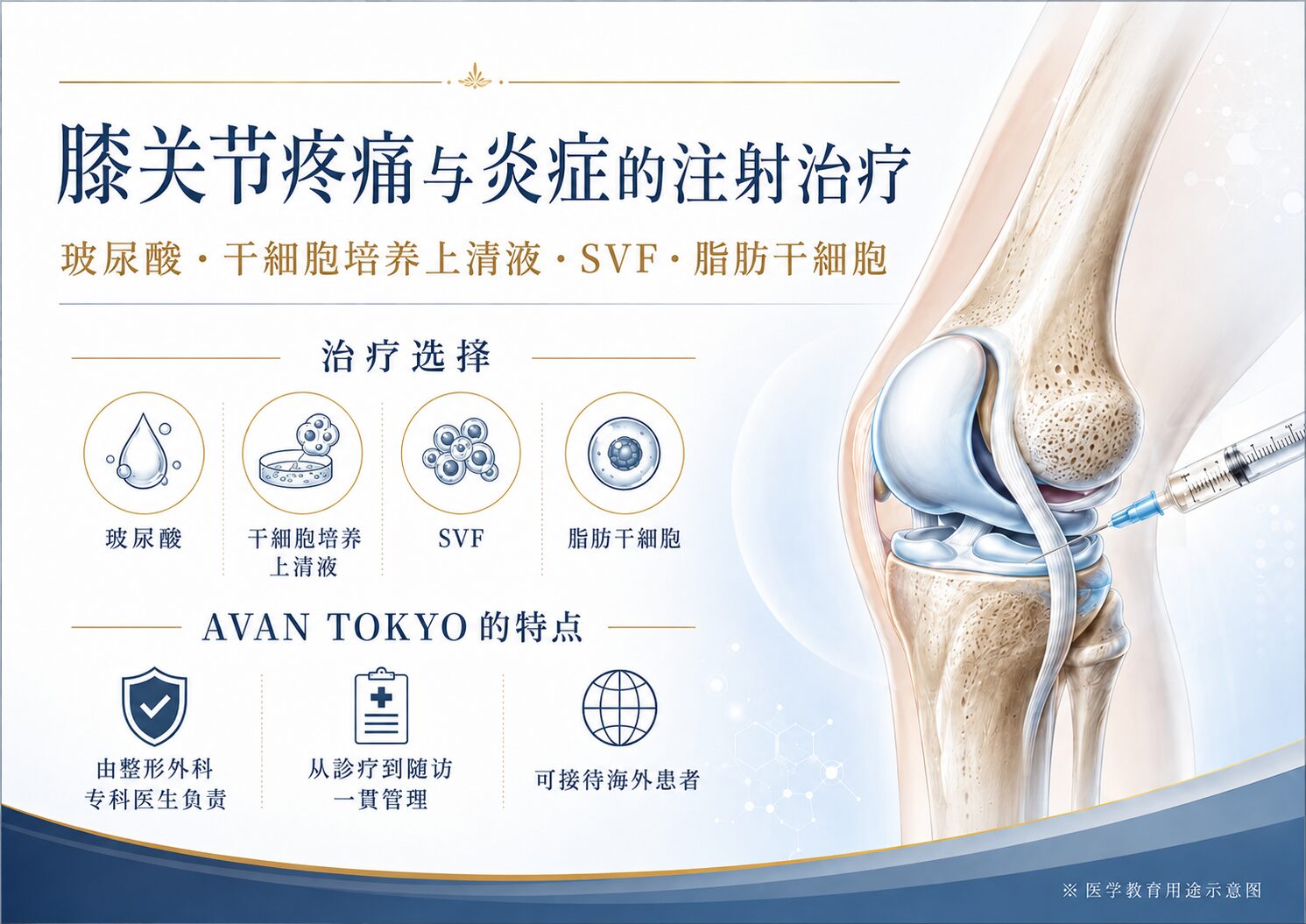 膝关节疼痛与炎症的注射治疗