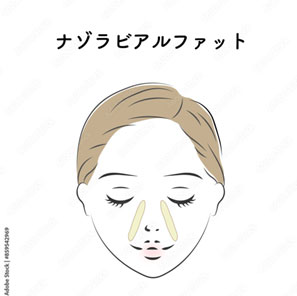 脂肪吸引 ダウンタイム 便秘 対策
