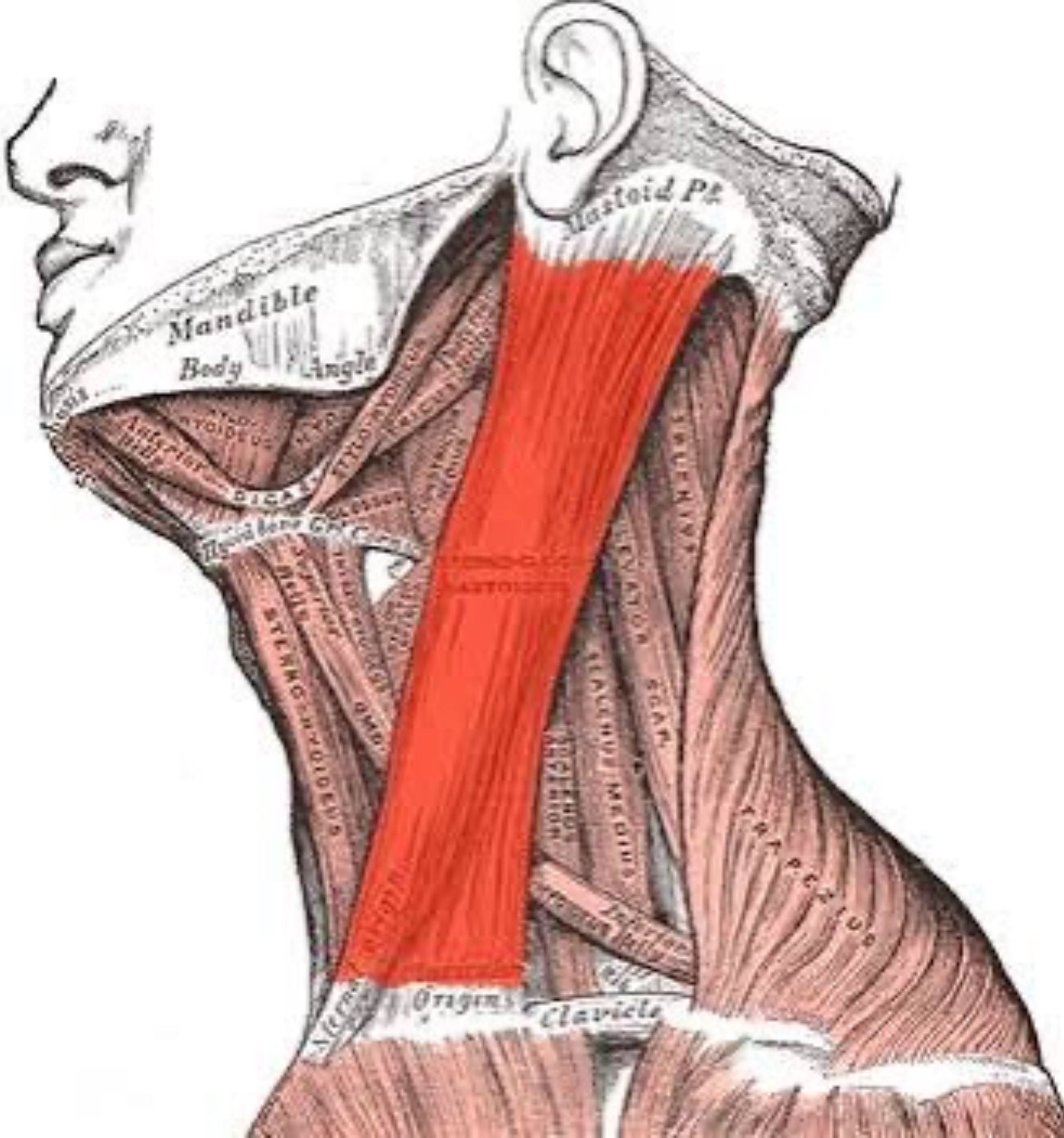 nâng ngực Hybrid rib flare khe ngực vòm ngực trước lồi