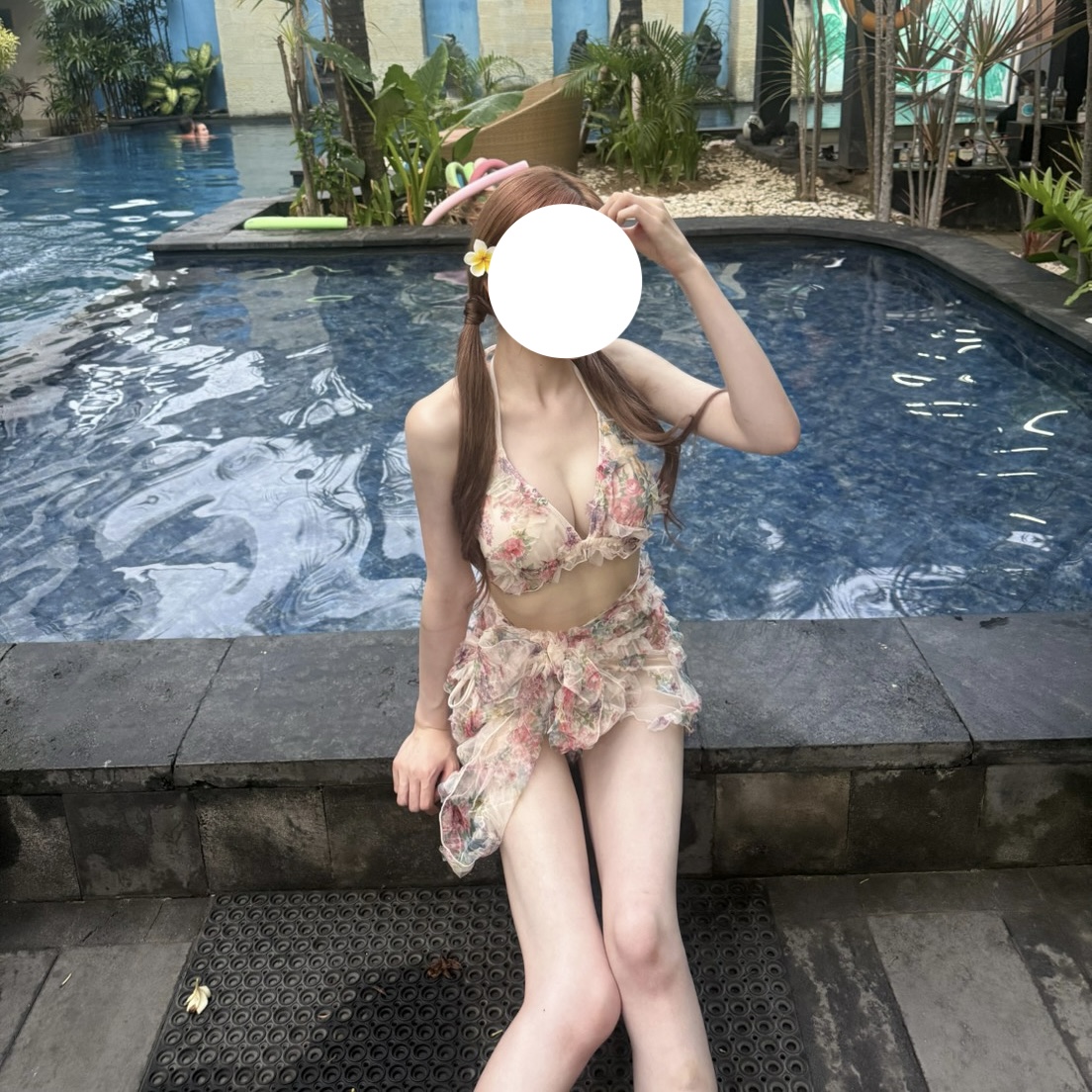 SSRI antidepressant liposuction bleeding platelet