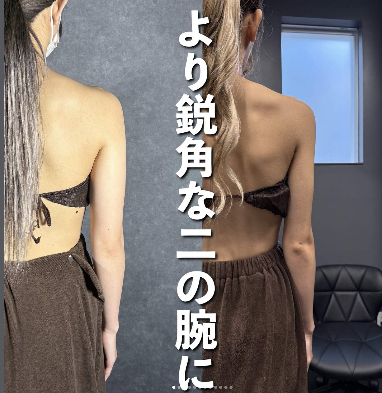 postpartum breast augmentation