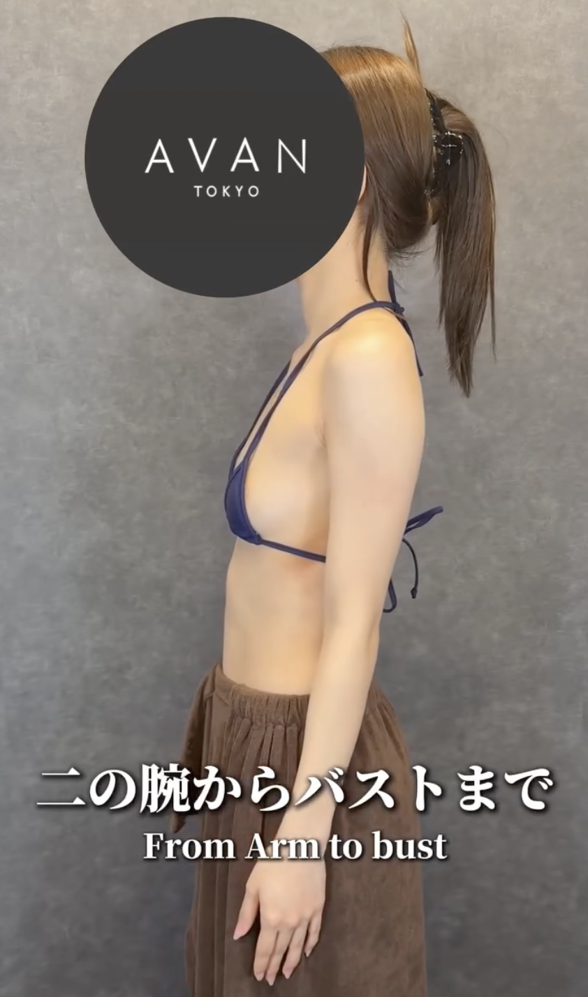 subcutaneous fat visceral fat liposuction abdomen