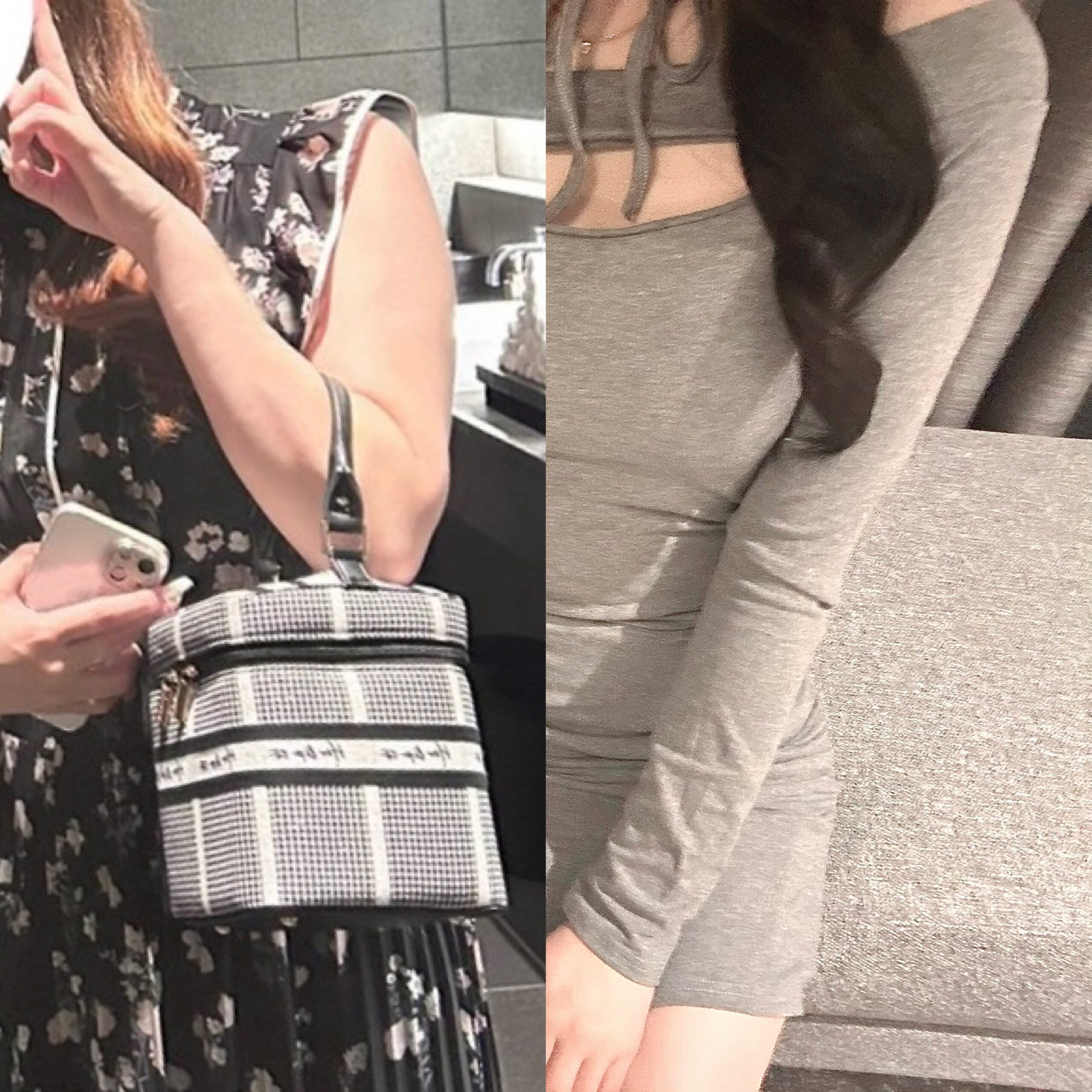 抽脂 術後 發抖 體溫管理