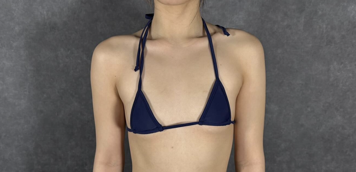 二の腕全周の脂肪吸引＋コンデンスリッチ脂肪豊胸 術前（正面）18歳女性