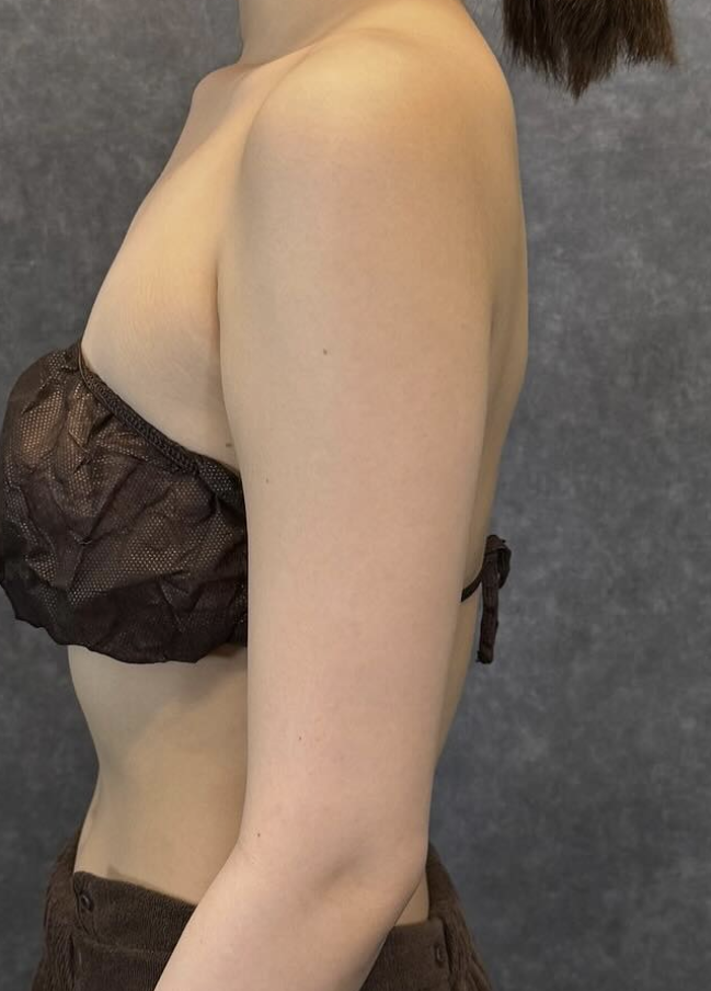 trước