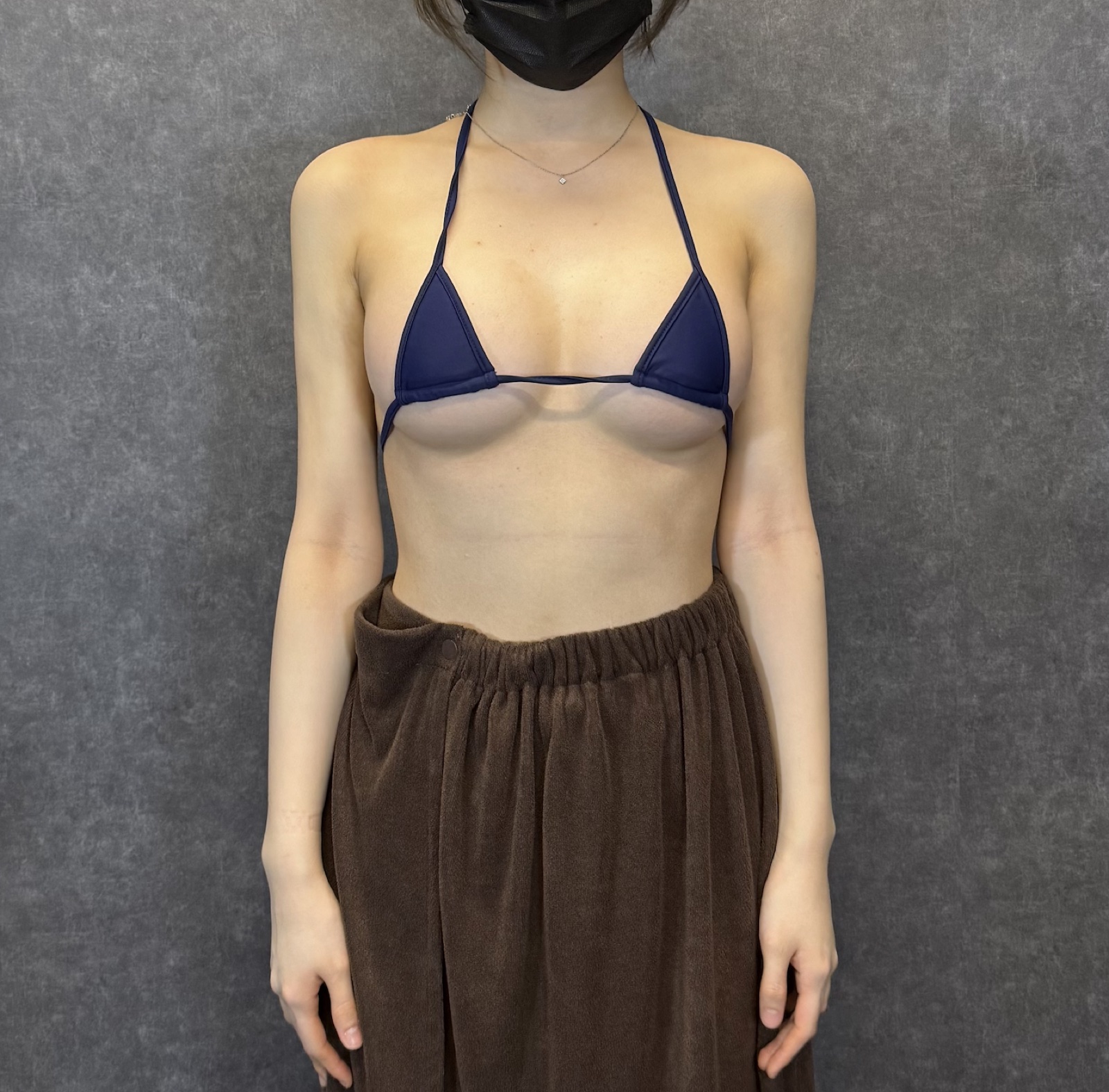 症例写真