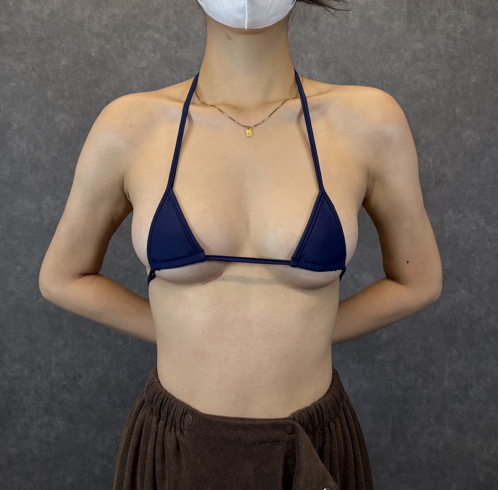 症例写真