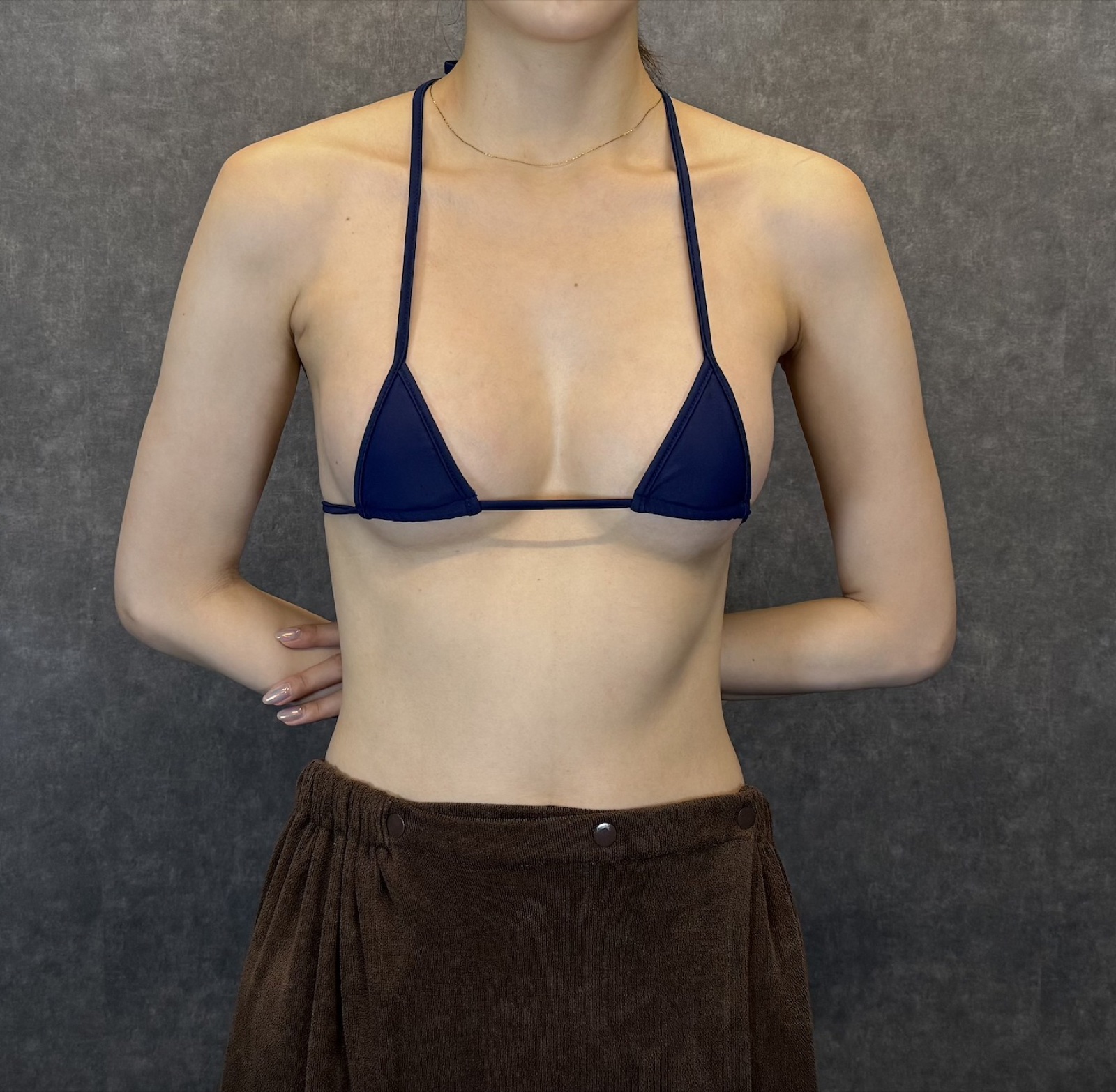 症例写真