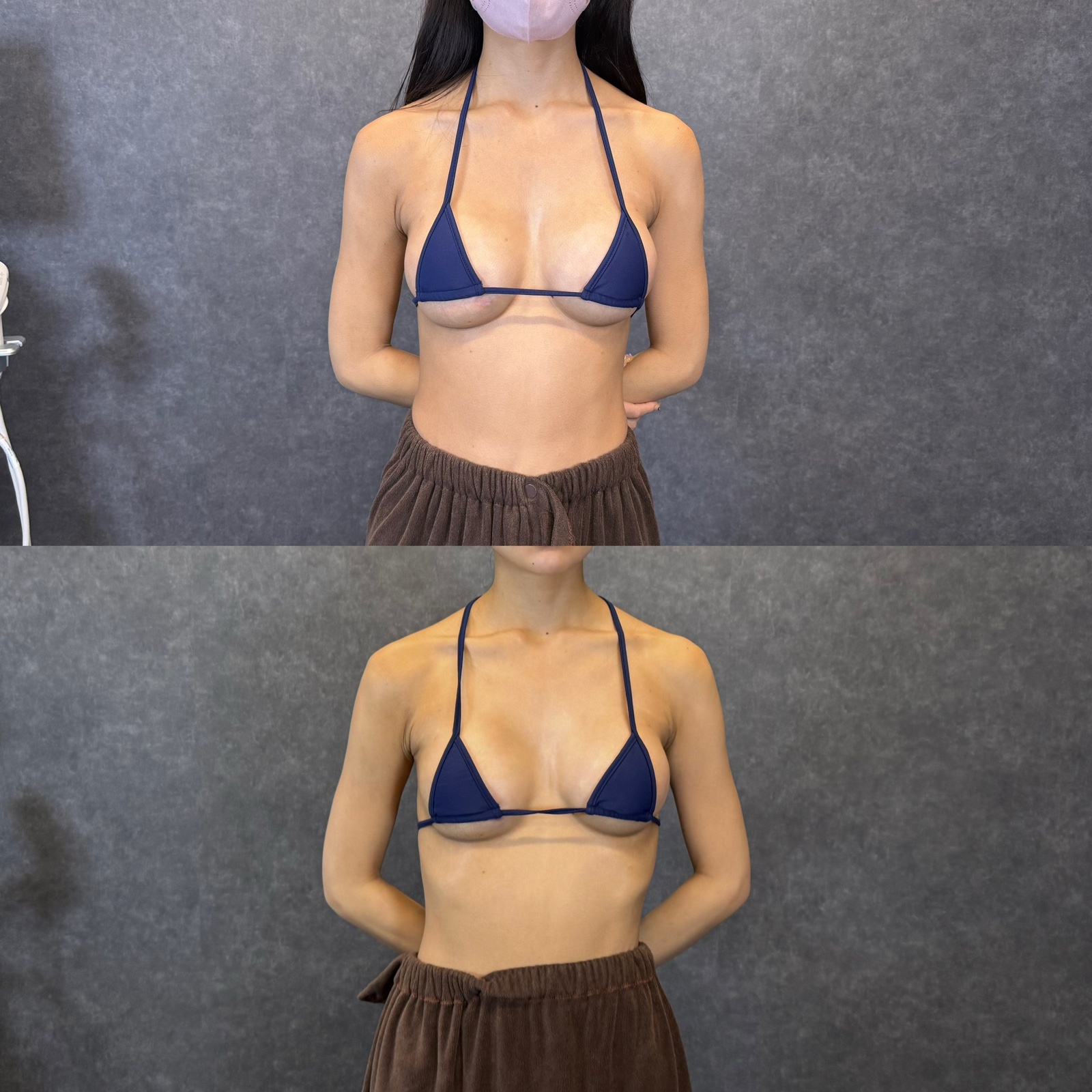 症例写真