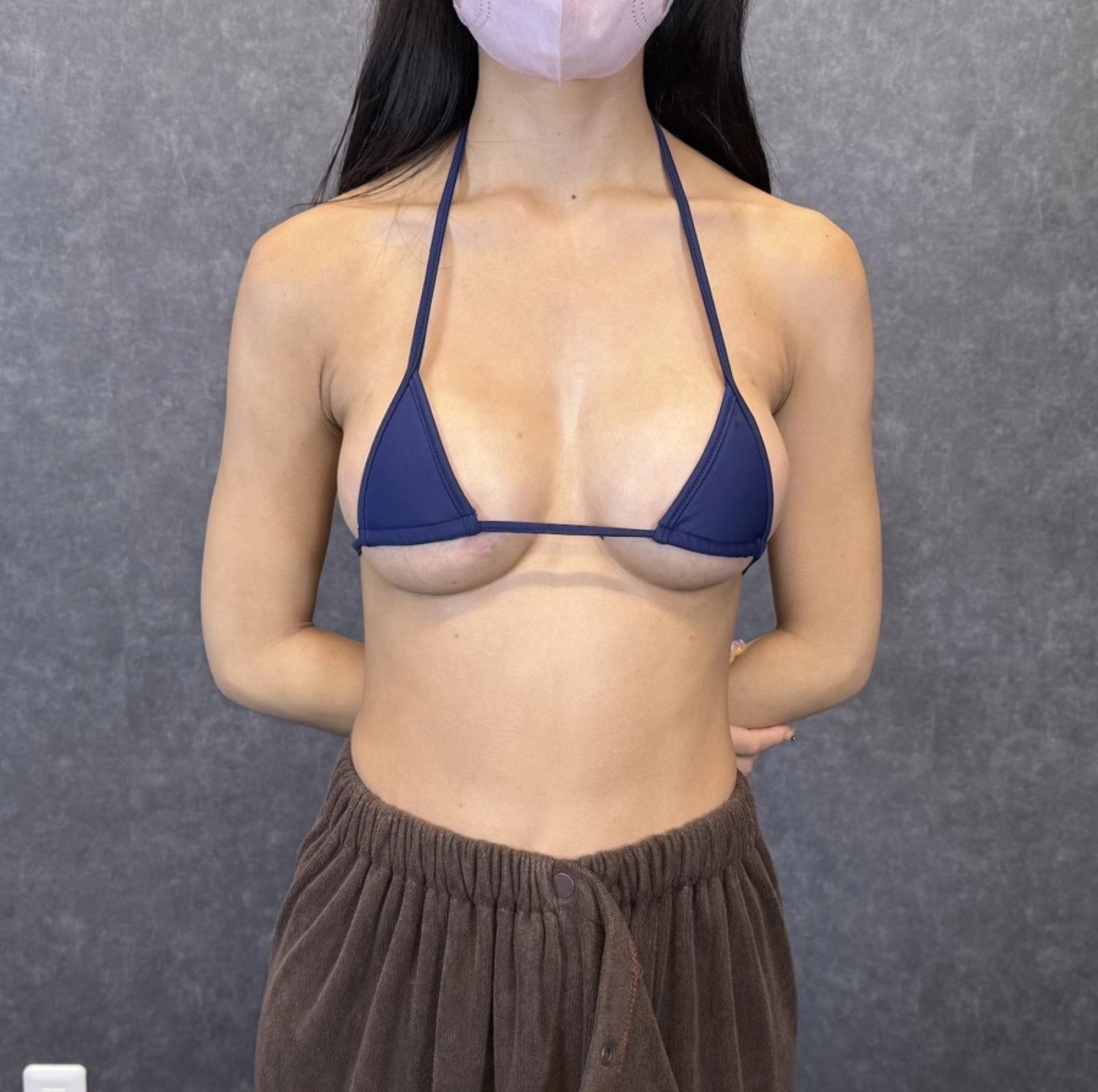 症例写真