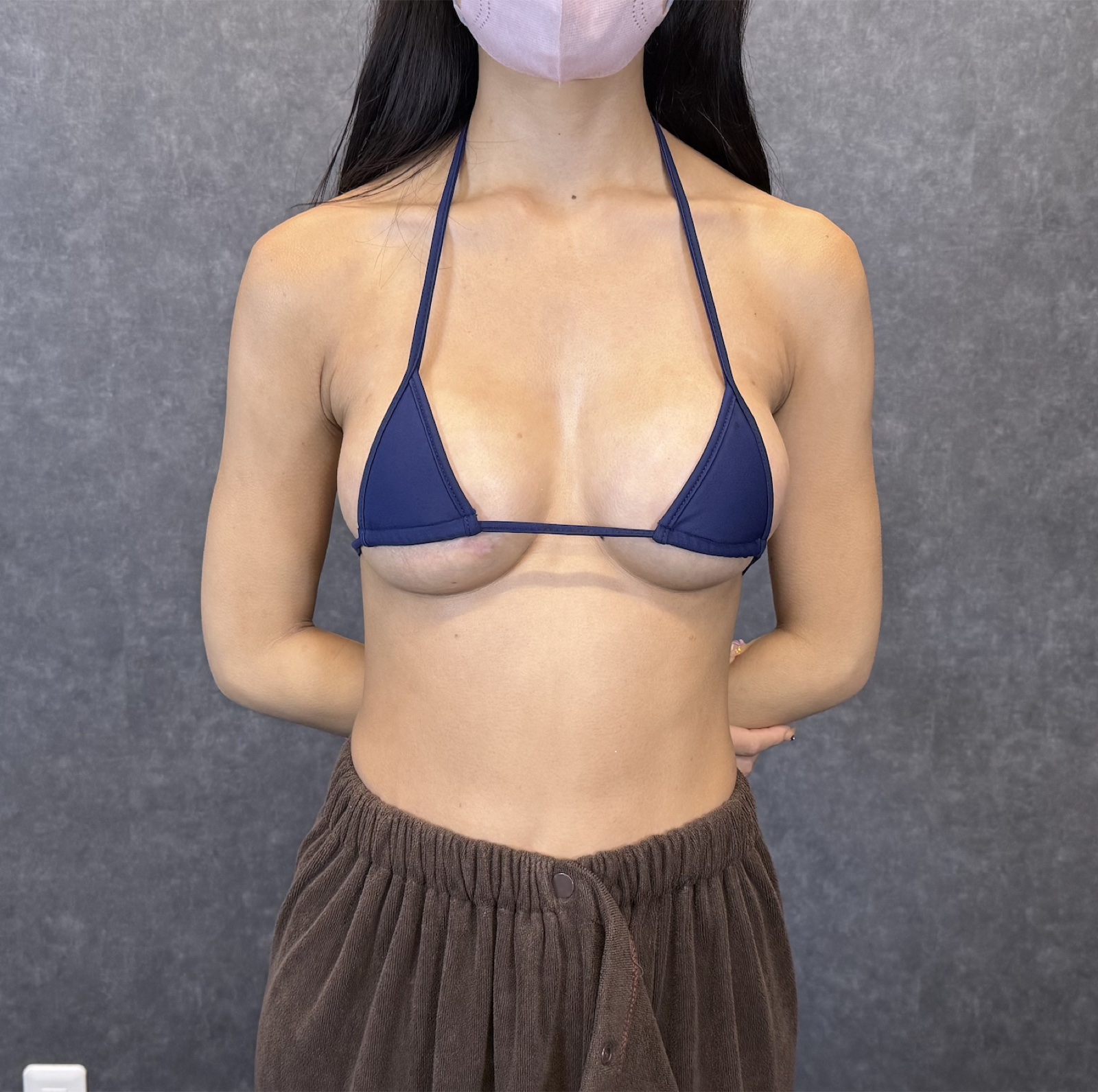 症例写真
