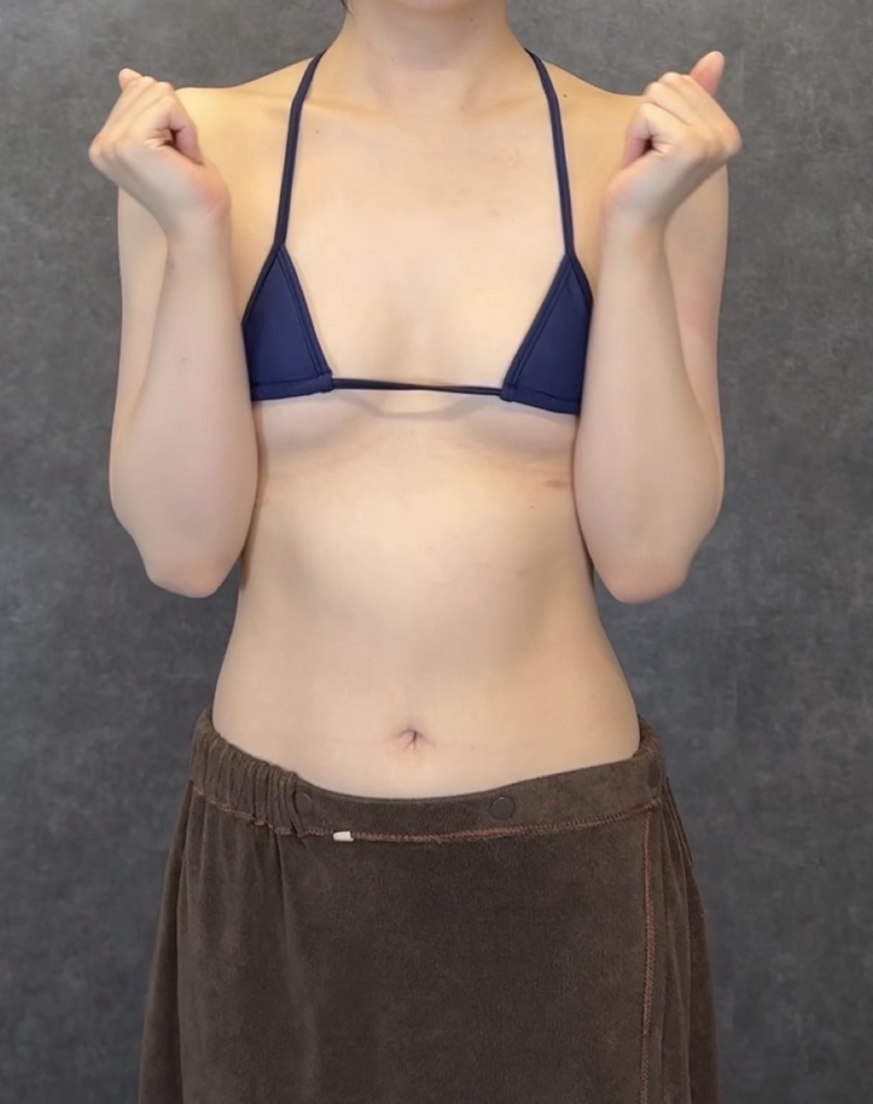 症例写真