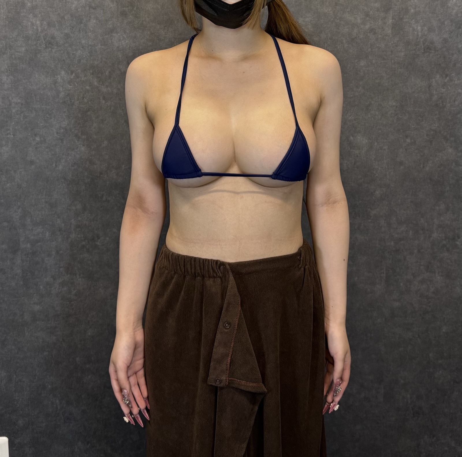 症例写真