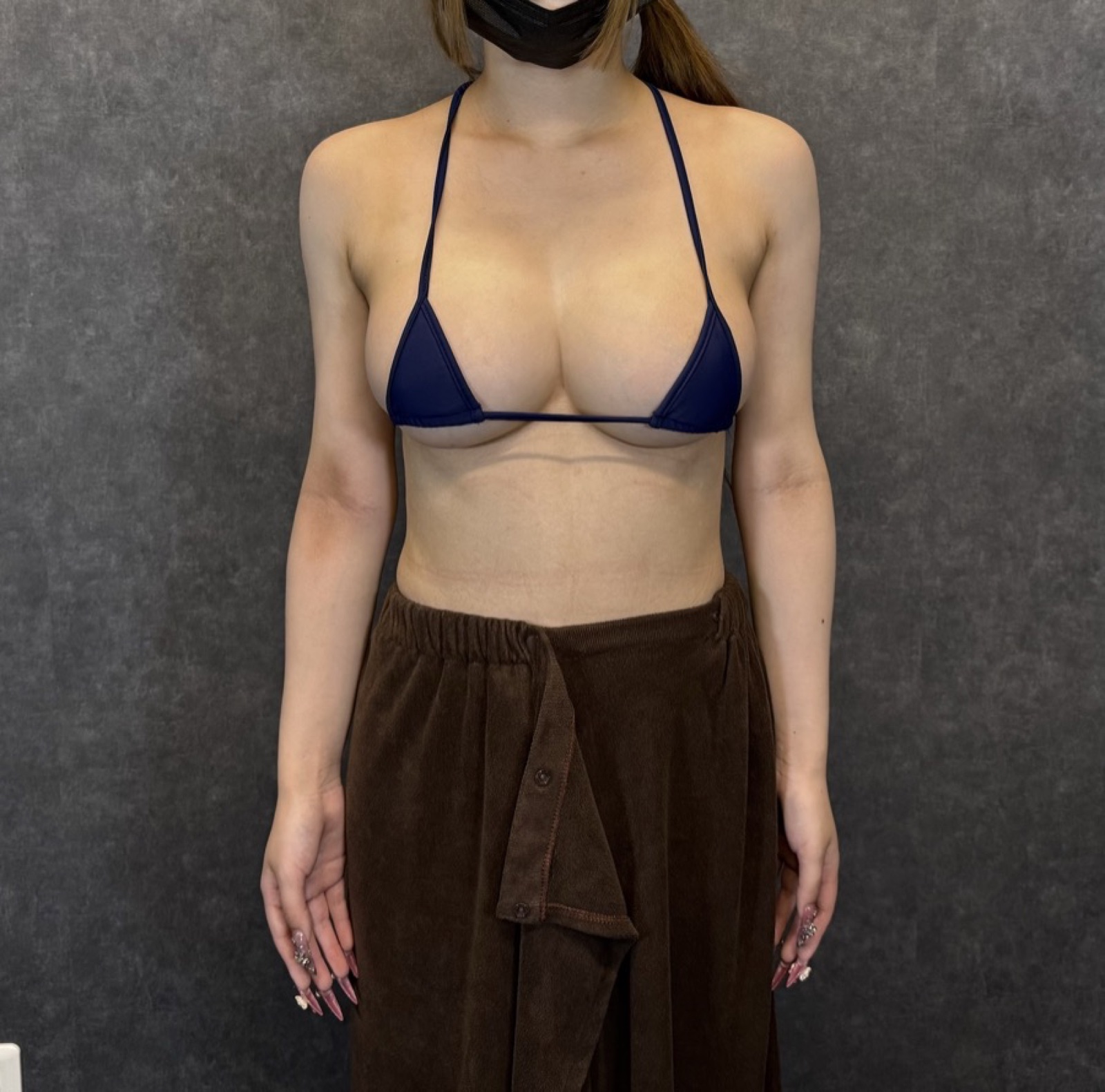 症例写真