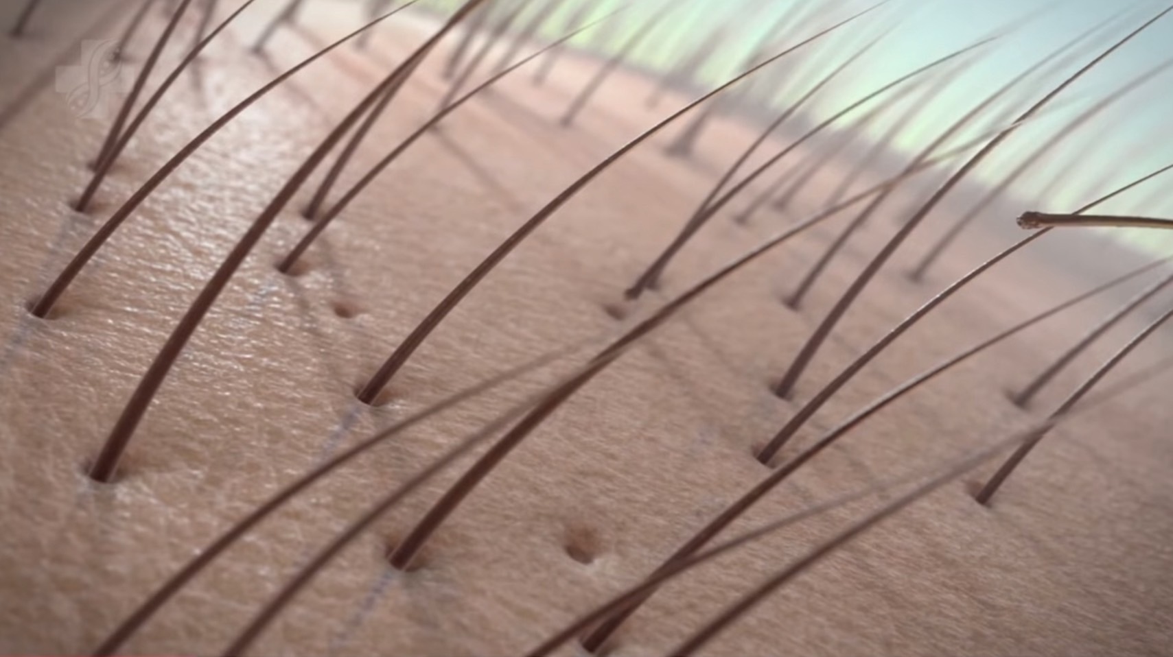 JAK inhibitor alopecia areata AGA hair loss regenerative medicine