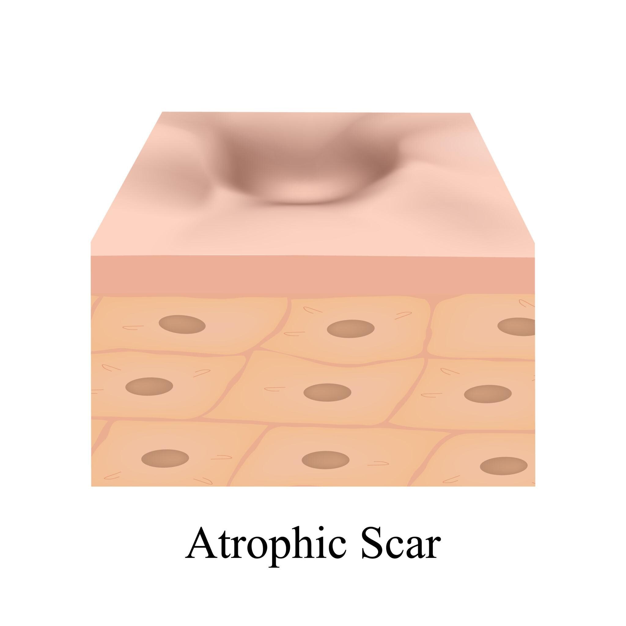 PRP stem cell conditioned media hair regrowth comparison