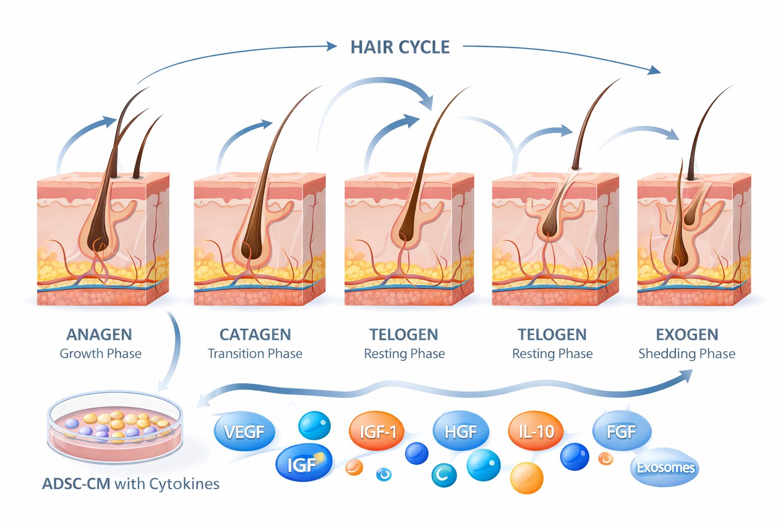 hair transplant stem cell conditioned media