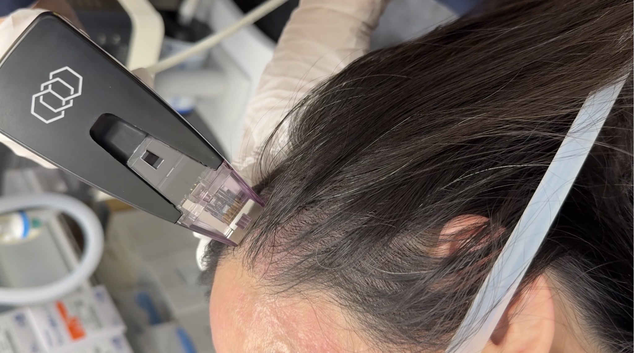 dutasteride finasteride AGA hair growth