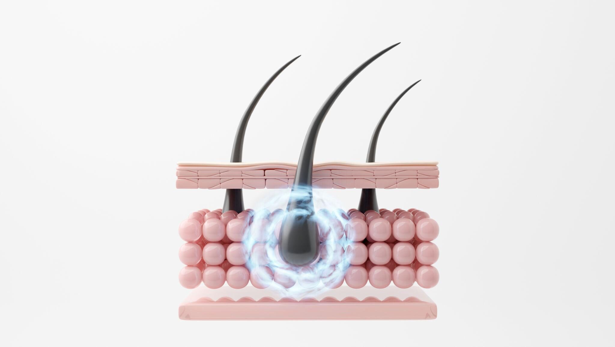 female hair loss iron deficiency ferritin scalp regeneration