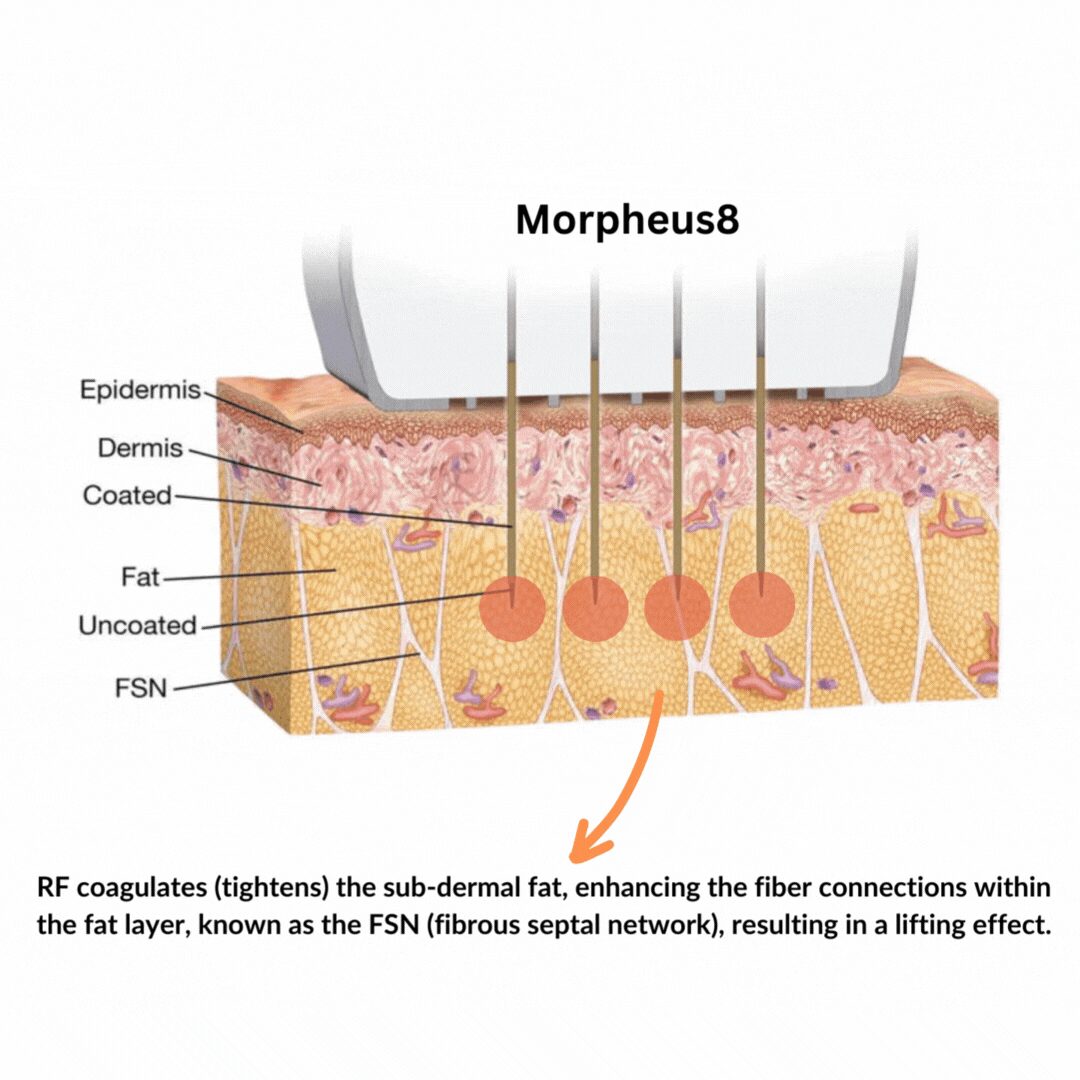 female pattern hair loss ludwig classification