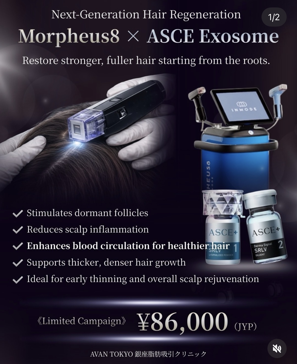 stem cell exosome miRNA hair follicle