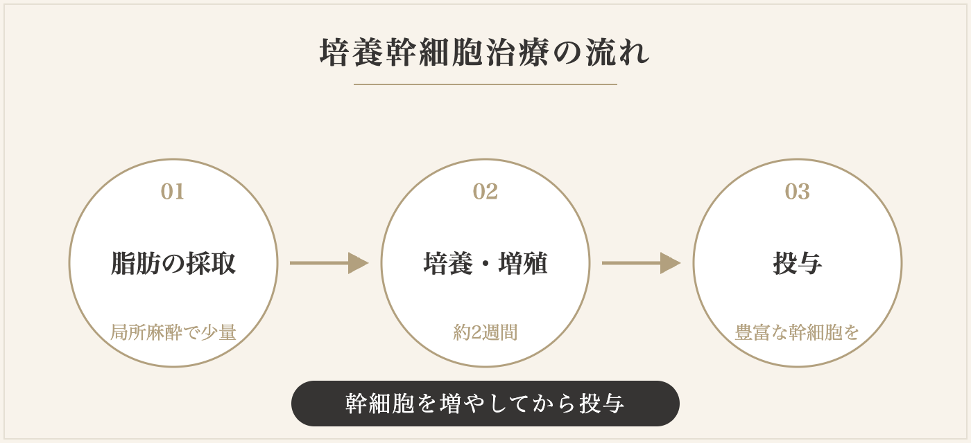 培養幹細胞治療の流れ：脂肪の採取・培養増殖・投与