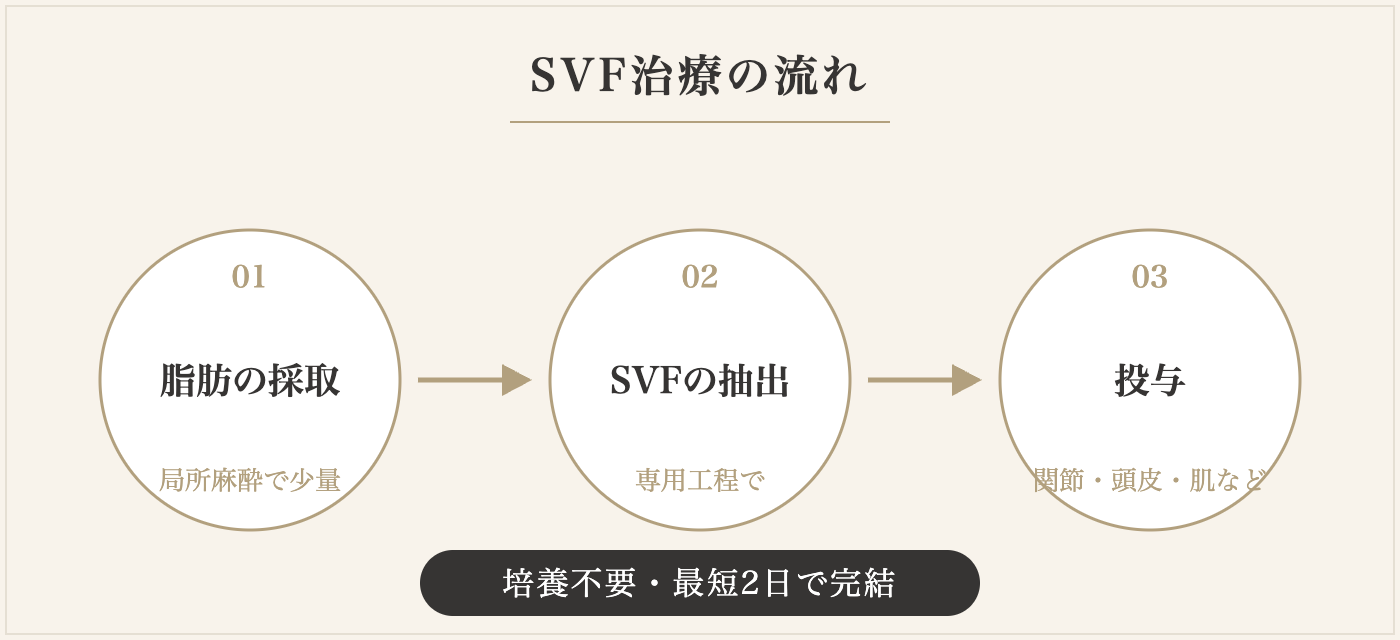 SVF治療の流れ：脂肪の採取・SVFの抽出・投与を最短2日で完結